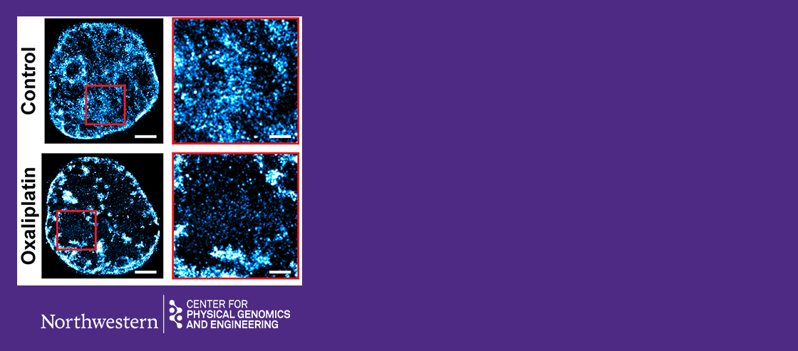 Targeting Chromatin for Cancer Therapy